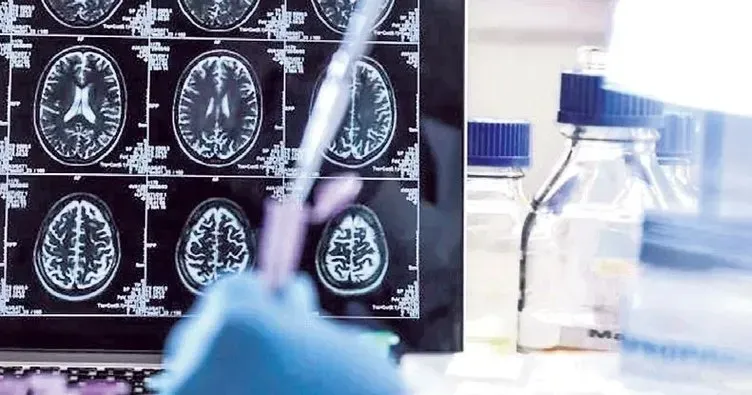 Alzheimer Kan Testi ile Erken Tanı Dönemi Başlıyor