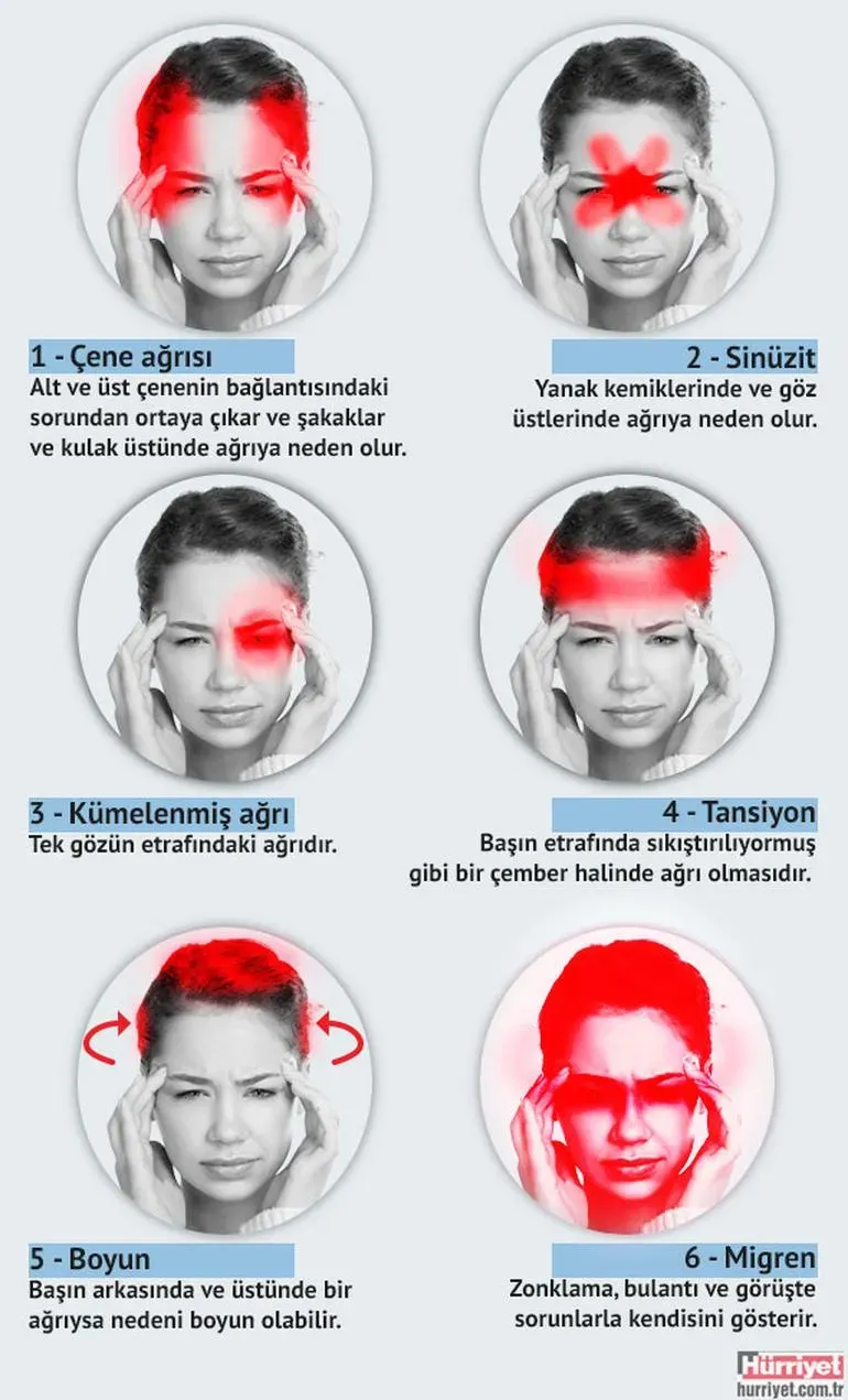 Baş ağrısı nedenleri: 5 işarete dikkat!