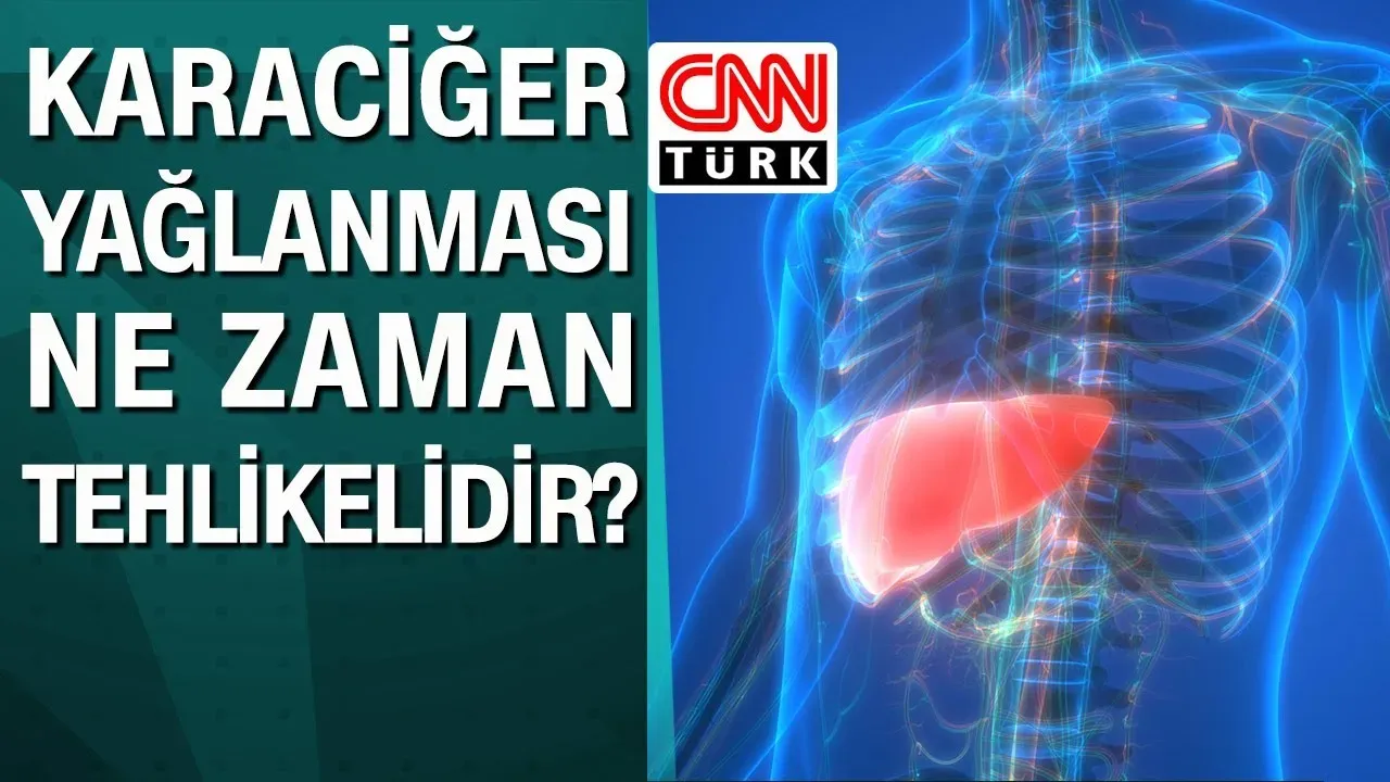 Karaciğeri Çürüten Alışkanlıklar ve Dikkat Edilmesi Gerekenler
