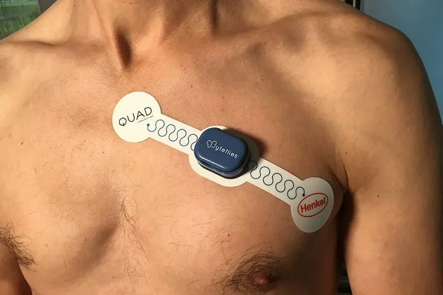 Smart patches for health monitoring: Advancing wearables