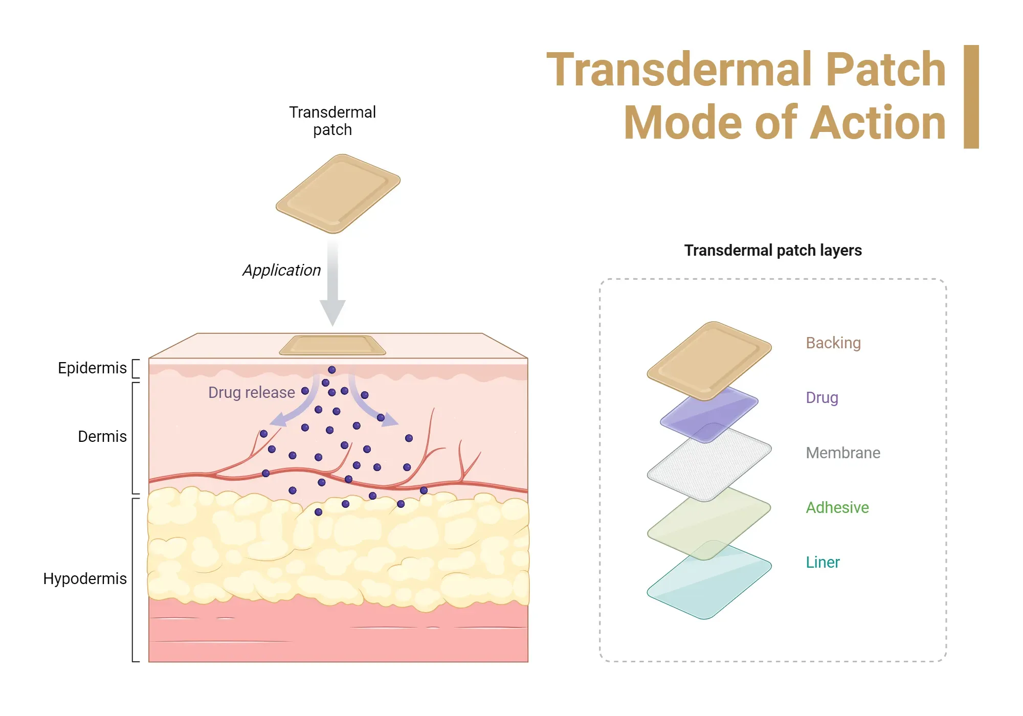 Transdermal patches: Unpacking patch technology today