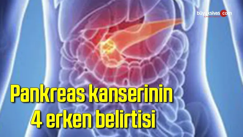 Pankreas Kanseri Belirtileri: Erken İşaretleri Tanıyın